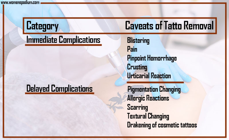 Caveats of Tattoo Removal 