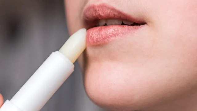 Natural DIY Treatments for Chapped Lips